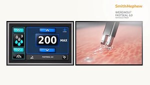 WEREWOLF FASTSEAL 6.0 Hemostasis Wand Animation