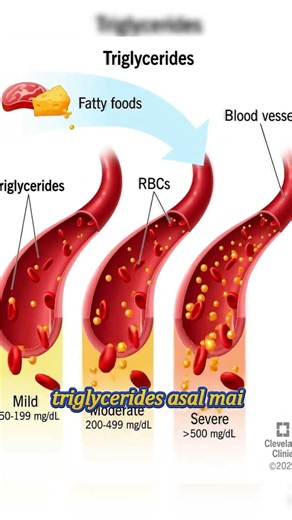 High Triglycerides Danger Explained | Cholesterol Se Bhi Zyada Risk?