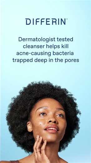 How-To Treat Acne with 10% Benzoyl Peroxide