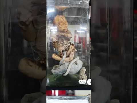 PATHOLOGY GROSS PART 1 SPECIMENS|LABORATORY MBBS PRACTICAL SAMPLES |ORGAN PATHOLOGIES |SECOND YEAR 