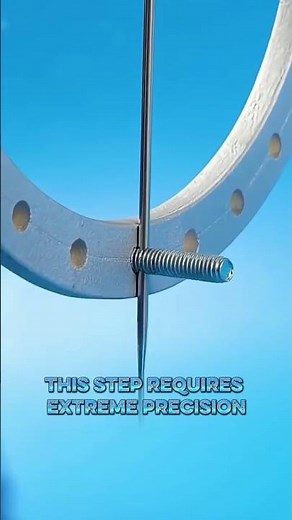 "Bone Lengthening Explained: The Ilizarov Technique in Action"