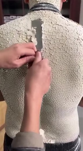 Exploring Trypophobia with Lotus-Hole Wall Insights