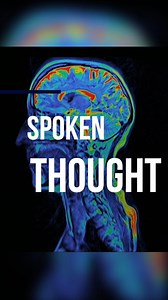 A UC Berkeley team developped an AI system that interprets brain activity to reconstruct speech, potentially aiding those unable to communicate verbally. This system requires an invasive surgery and a lot of practice, but researchers are hopeful for further breakthroughs in this field. | China Daily Hong Kong