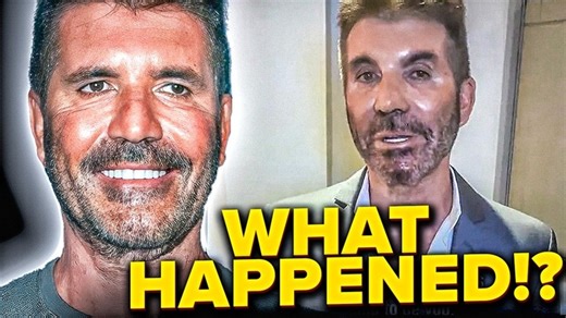 What Happened to Simon's Face | Tickld