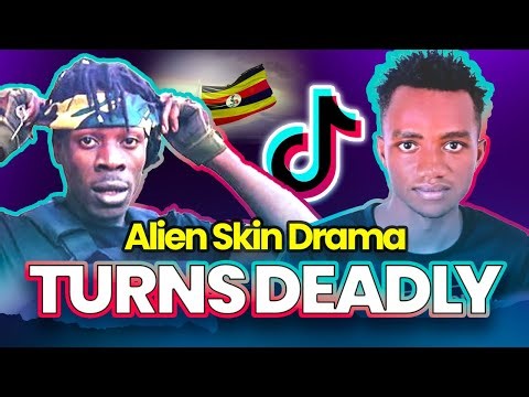 Alien Skin Allegations: TikTok Dancer Speaks Out Against Violence #AlienSkin #Uganda2026Elections