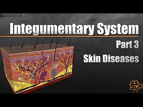 Integumentary System Part 3 of 3 Diseases of the Skin
