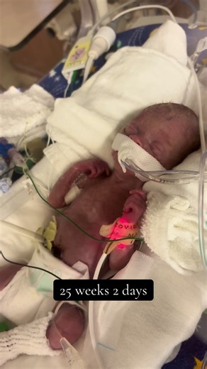 Celebrating My Sweet Preemie Boy's Journey