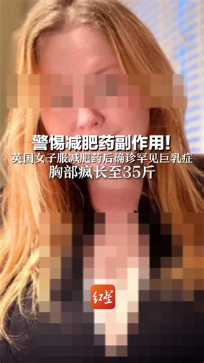 警惕减肥药副作用！ 英国女子服减肥药后确诊罕见巨乳症 胸部疯长至35斤 “巨大的重量会压迫胸腔 无法呼吸”