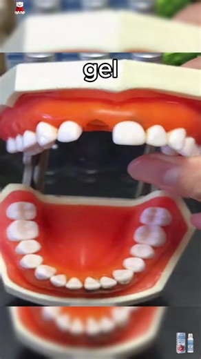 One Minute Tooth Replacement: A Quick Guide