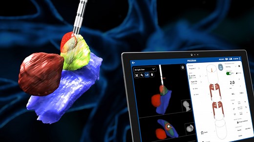 Boston Scientific’s next innovation in Image Guided Programming, Vercise™ Neural Navigator 5 (VN5) Software