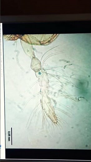 Under Microscope, 🐞Trichogramma🐞 dendrolimi Matsumura, are parasitic wasps, Hymenoptera. Biocontrol.