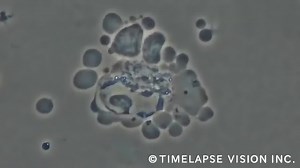 免疫细胞是这样杀死癌细胞的！（NK细胞篇）