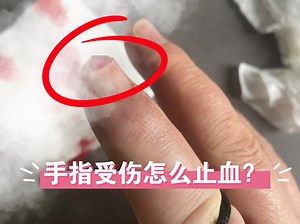 手指受伤后该怎么止血？一个视频告诉你。你有可能都做错了。