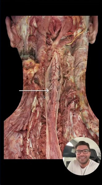 Can you identify this structure?💯 #medschoolbootcamp #medicine #Medical #MedStudent #MedicalStudent #MedSchool #MedicalSchool #Doctor #Resident #Hospital #MD #Med #Anatomy #Science #Whitecoat #WhiteCoatCeremony #MS1 #MS2