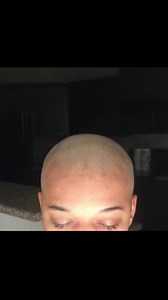 My hair journey from the beginning, I cut my hair bald to restart my growth back to health I was dyeing my hair and frying it so I decided to do a restart | Mell Mell
