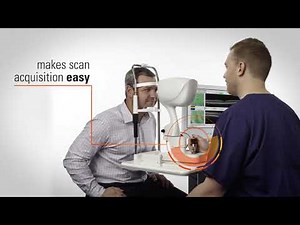 Optovue OCT Systems Overview