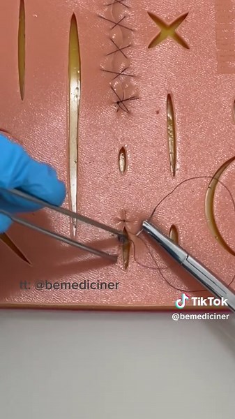 Inverted Simple Suture Technique Explained for Medical Students