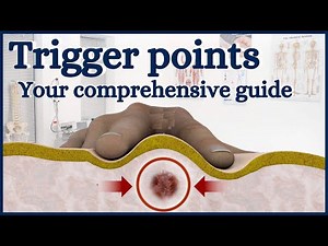 Guide to trigger points