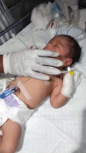 so Cute baby beautiful nosal 😍❤️ #trendingshorts #nursing #newbornbaby #beutiful #cute #viralbaby | Talim Tigers Talim Tigers