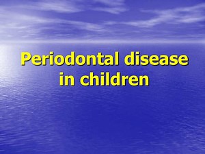 PPT - Periodontal disease in children PowerPoint Presentation, free download - ID:445960