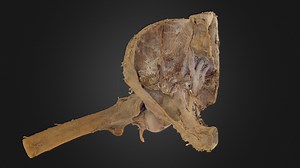 Deep Hip Joint - 3D model by UBC Medicine - Educational Media