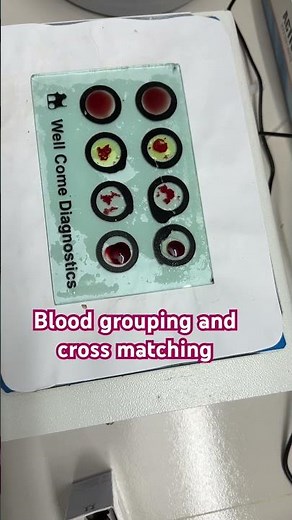 Blood grouping and cross matching #blood #bloodgroup #crossmatching #ataur #ataurrahman #nursing