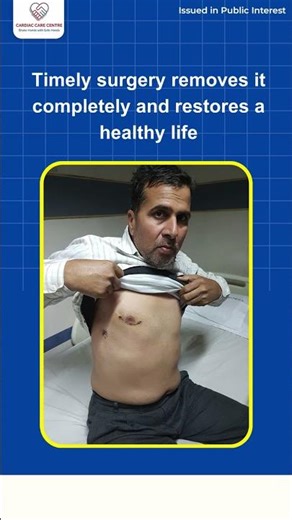 LA में जीवन बचाने वाली मायक्सोमा सर्जरी दुर्लभ हार्ट ट्यूमर के बारे में बताया गया |Dr. Kshitij Dubey