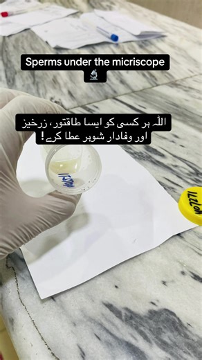 Sperms under the microscope 🔬 #semenanalysis #fertility #pregnancy #viral