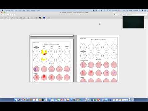 The use of qEEG's in treatment