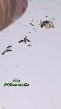There are so many lice. #satisfying #scgasmr #hair #hairextensions