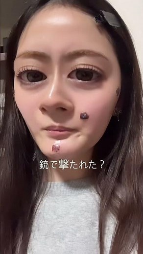 【ほくろ除去】簡単に垢抜ける方法