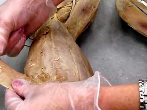 Abdominal Muscles - Cat AP1