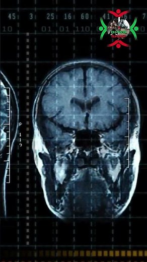 What Is an AI Algorithm? | How Artificial Intelligence Actually Works