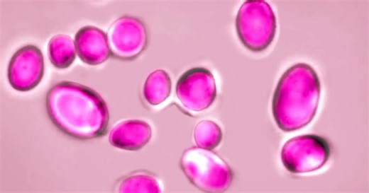 Dangerous superbug spreads in US hospitals: What you need to know