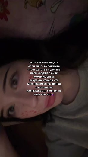 Understanding Acne: Red Spots on Cheeks Remedies