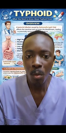 Understanding Typhoid Fever: Causes and Contagion