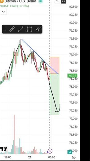 Best Forex & Crypto Trading Strategy 2026 | Price Action & Support Resistance | Join Telegram