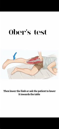 Special test of hip joint obers test #youtubeshorts #anatomy