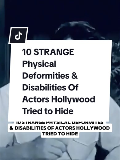 10 Unique Deformities Actors Have Hidden