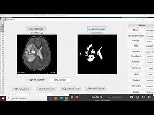 Brain MRI Tumor Detection and Classification