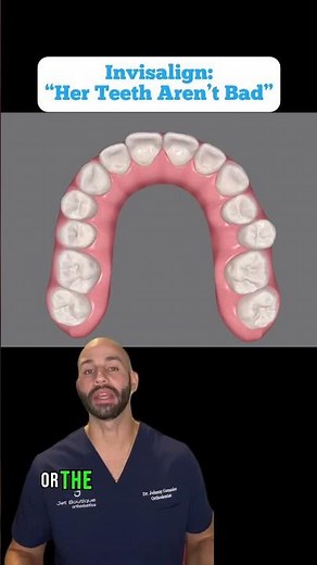 Invisalign Smile Design Timelapse: Before and After (2023)
