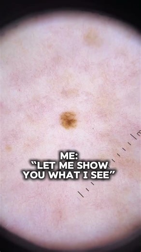 During a skin cancer screening exam, I hear this frequently from patients
