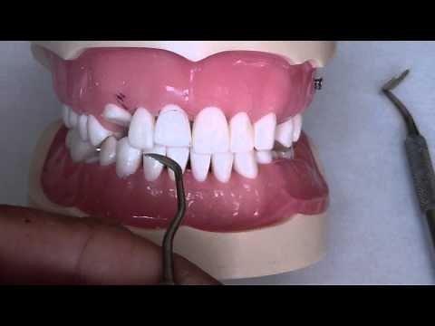 Composite Finishing - Flash Removal