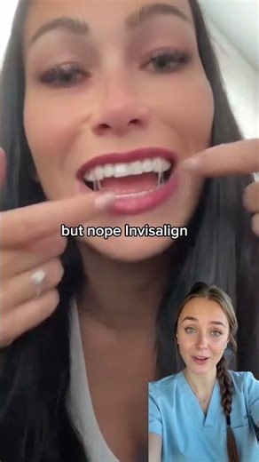 How to Use Invisalign Elastics Correctly