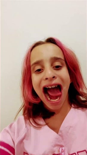 Hey everyone I got my expander!!!