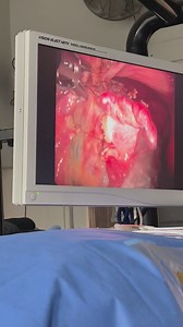 2.6K views | Weston Davis Equine Surgery on Reels | Facebook