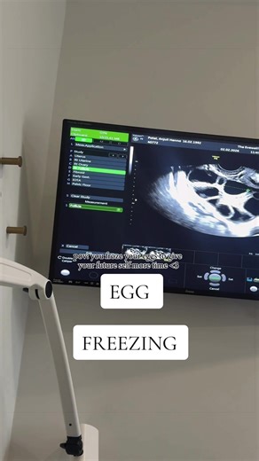 You’re running out of time.” Something women hear far too often. So in January this year, I decided to take back a little control over my future… and froze my eggs. 🥹 Sharing this on International Women’s Day because every woman deserves choice when it comes to her timeline. If you’ve ever wondered about egg freezing - the hormones, the process, the emotions, the cost - ask me anything below and I’ll share my experience openly. 💜⬇️ #eggfreezing #internationalwomensday #eggfreezingjourney #eggf