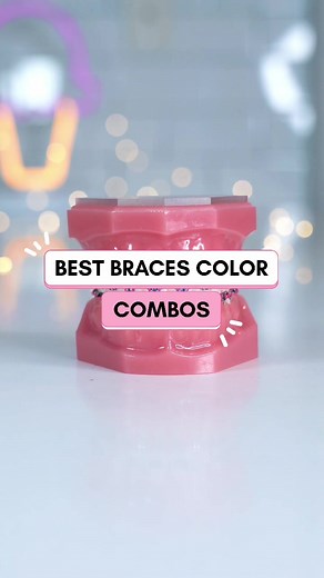 Braces Color Combos: Find Your Perfect Match