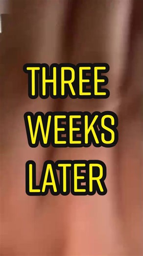 3 weeks later… My Keto Diet Progress. I don’t look like i lost 5kgs, but honestly, I feel really great. ❤️ #fyp #foryou #ketodiet #tiktokphilippines
