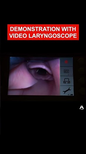 CMAC video intubation demo | #airway #intubation #shorts